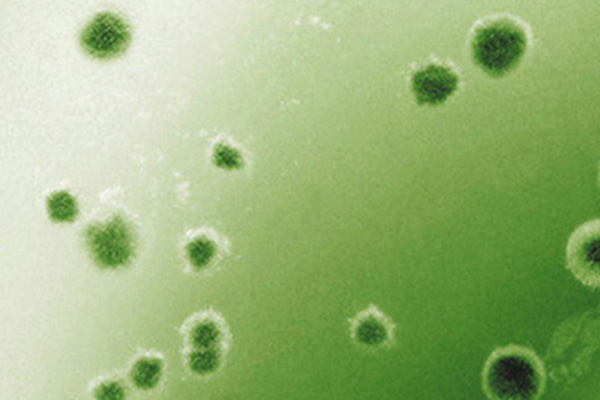 Schimmel in Innenräumen stoppen